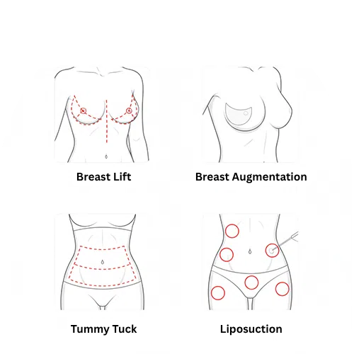 Post Pregnancy Surgery Perth