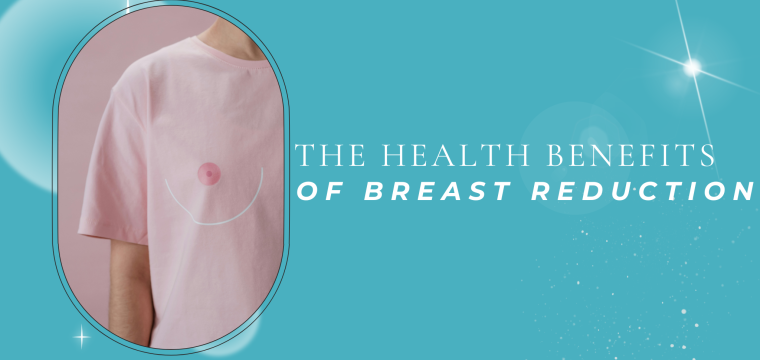 the health benefits of breast reduction